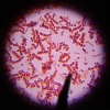 bacteria fractal